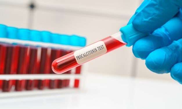 Emerging Biomarkers for Early Detection of Bacterial Infections